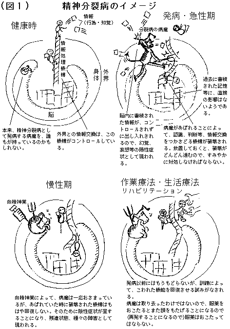 精神分裂病